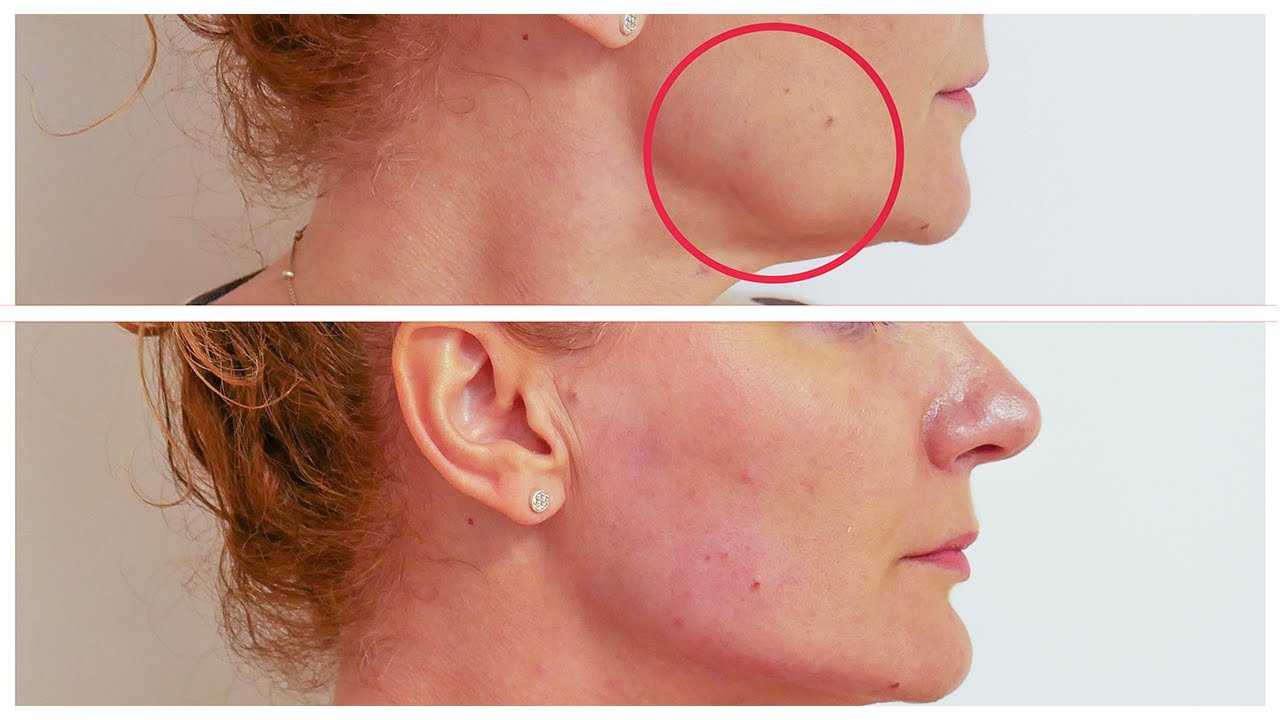 ✨MASAJEADOR FACIAL REDUCTOR DE ARRUGAS Y PAPADA - ¡SOLUCIÓN PARA UN ROSTRO RADIANTE!🚀 ENVÍO GRATIS